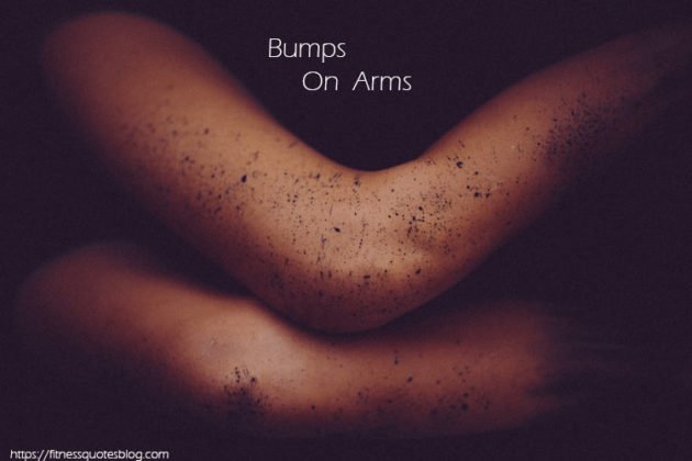 How To Get Rid Of Bumps On Arms Fitness Quotes